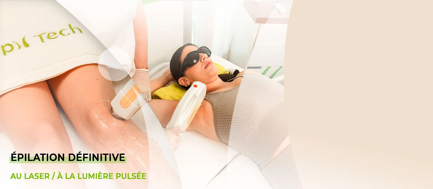 Épilation définitive professionnelle au laser et à la lumière pulsée chez EpilTech