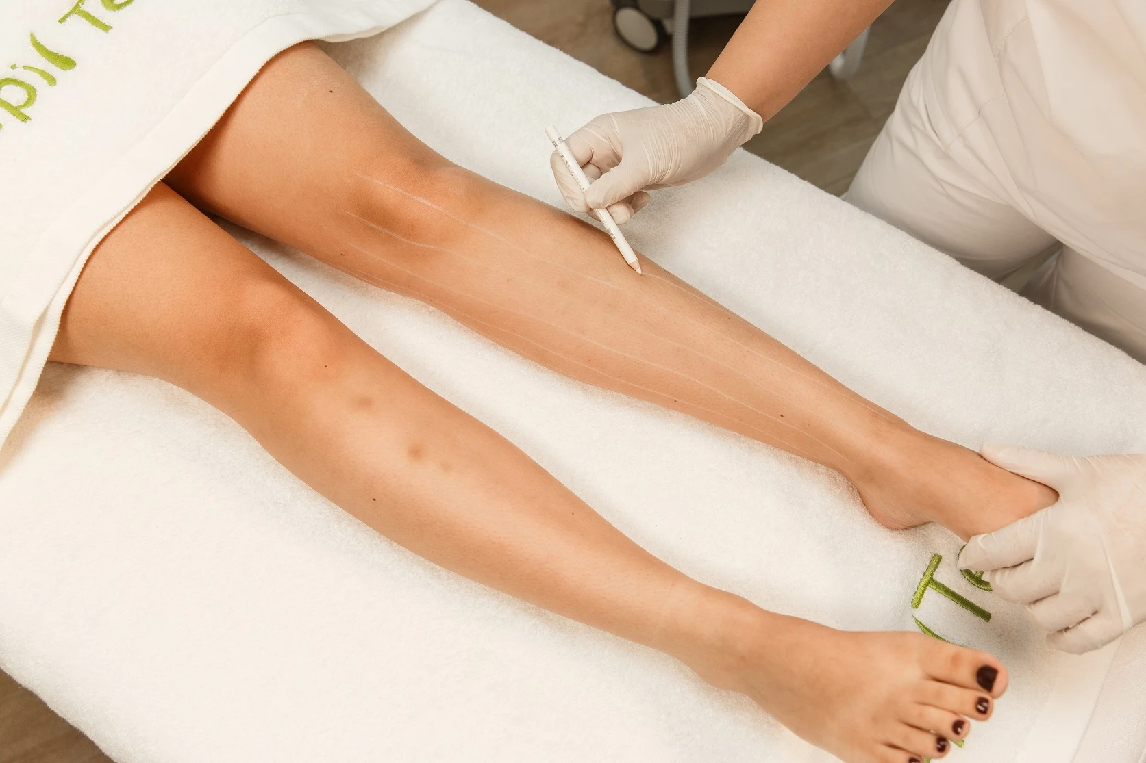 Épilation définitive au laser