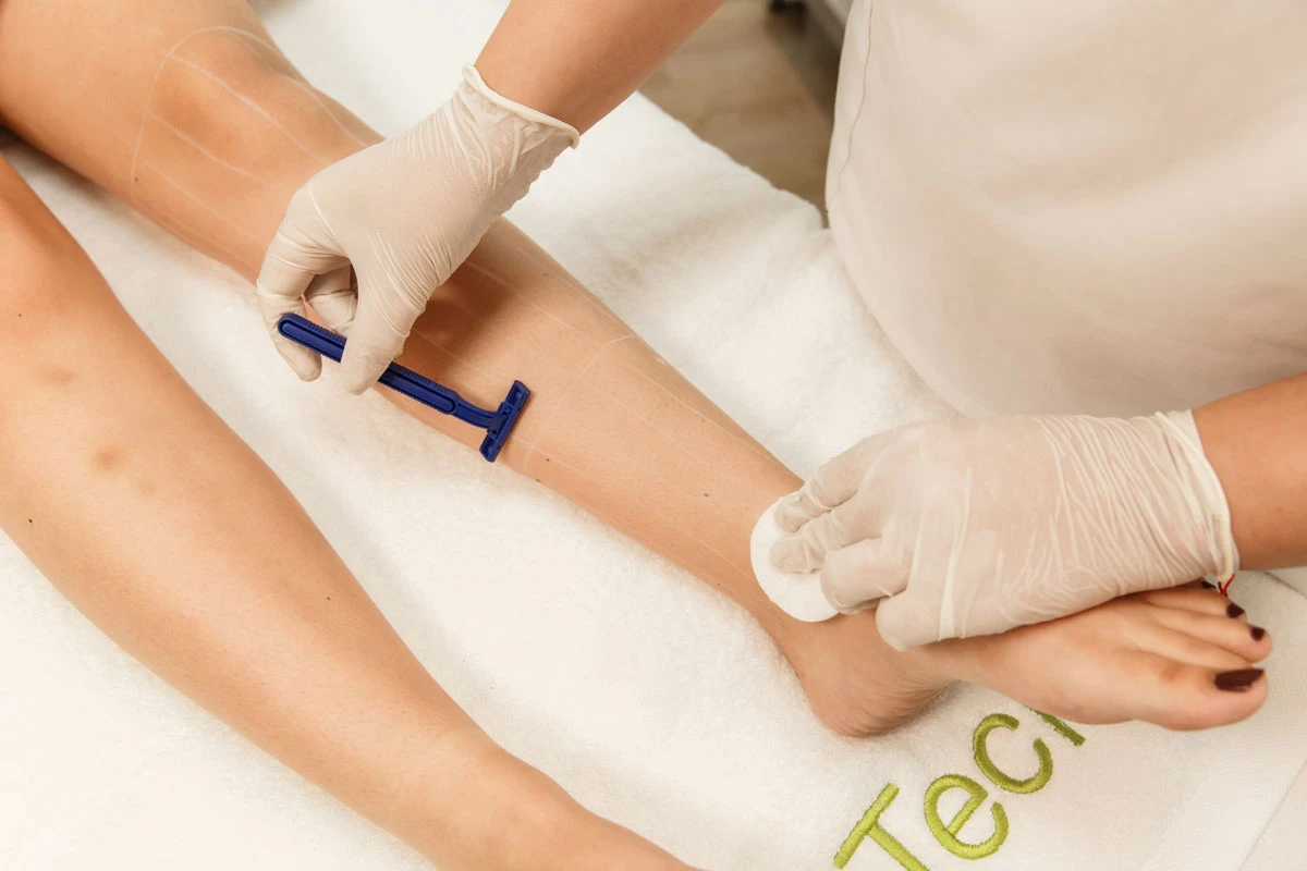 Pack épilation à la lumière pulsée